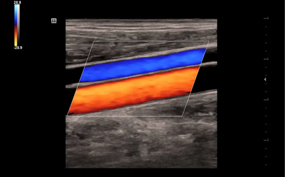 Carotida color DC-30